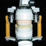 Dental lab articulator