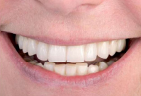 Cosmetic dentistry smile