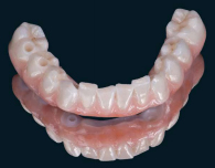 cosmetic dental teeth