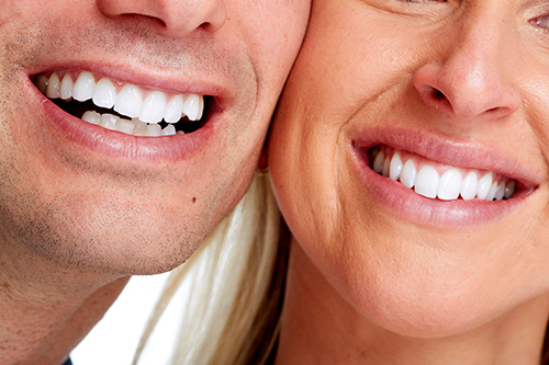 Couple with cosmetic dentistry