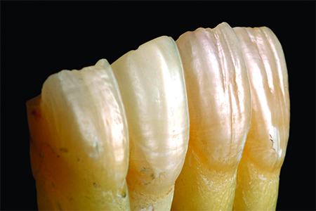 light on tooth