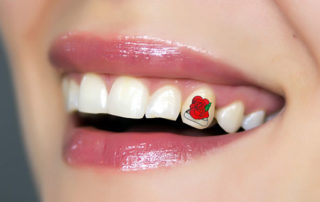 rose tooth tattoo